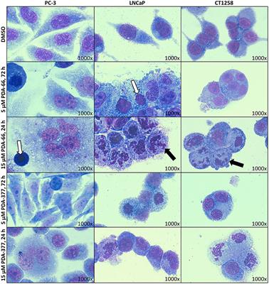 PDA Indolylmaleimides Induce Anti-Tumor Effects in Prostate Carcinoma Cell Lines Through Mitotic Death